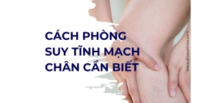 cach phong suy tinh mach chan can biet